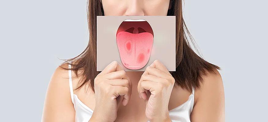 Insights into Menopause: Dry Mouth at Night